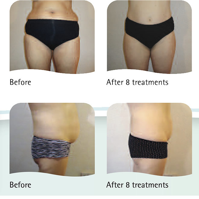 Lipogenie-results-2